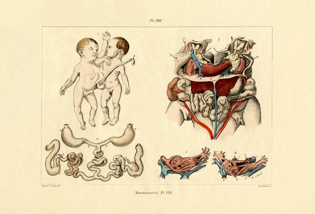 Anormal, 1833-39 de French School