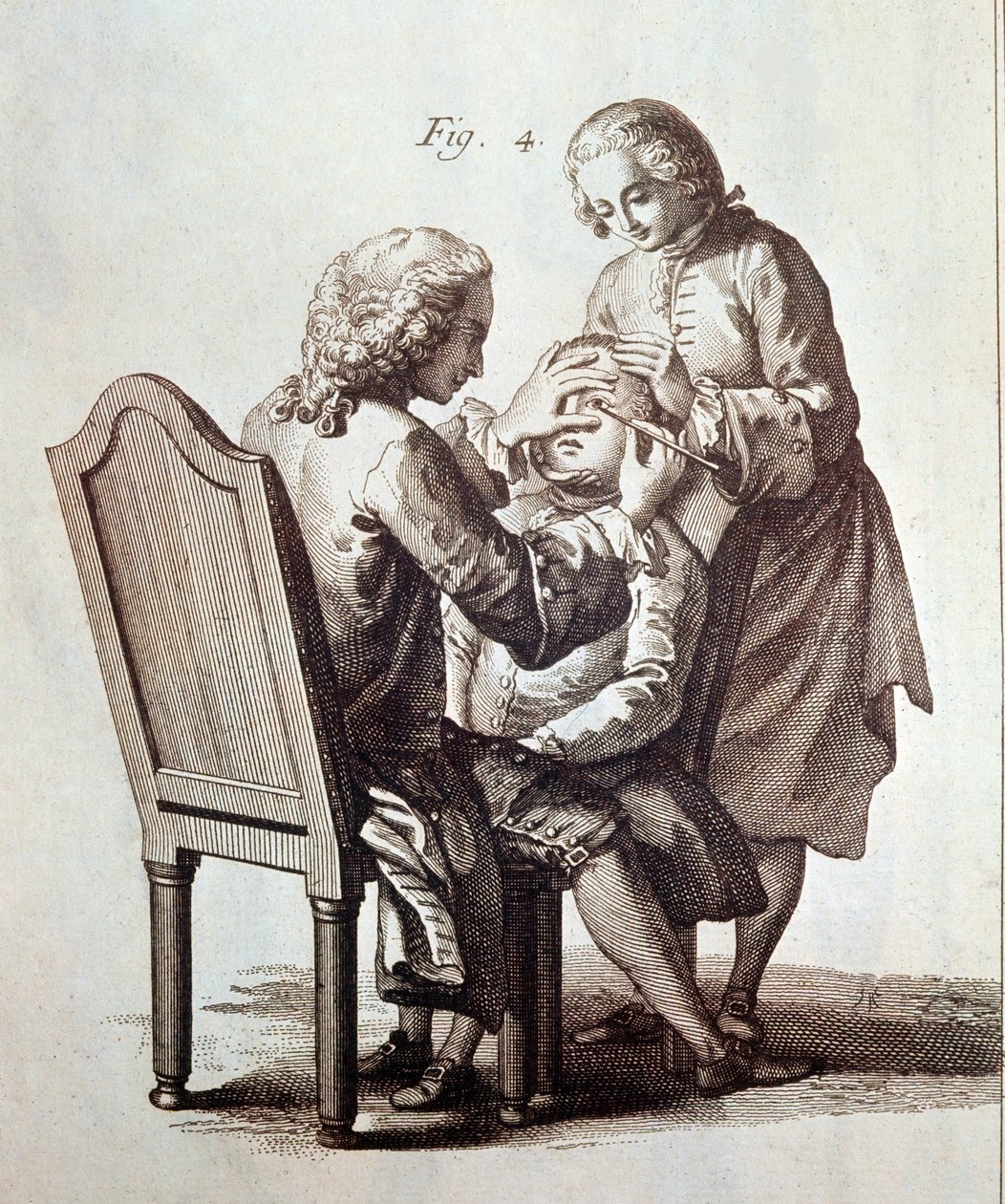 Um médico a operar um doente com cataratas, ilustração da Enciclopédia Médica de Denis Diderot e Jean le Rond d