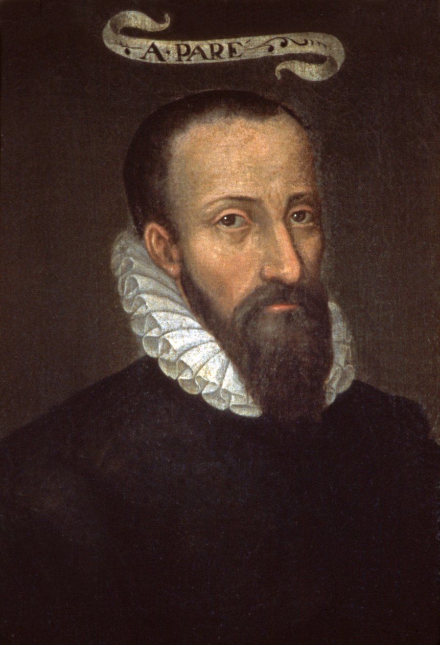 Ambrósio Pare. Século XVI (pintura) de French School