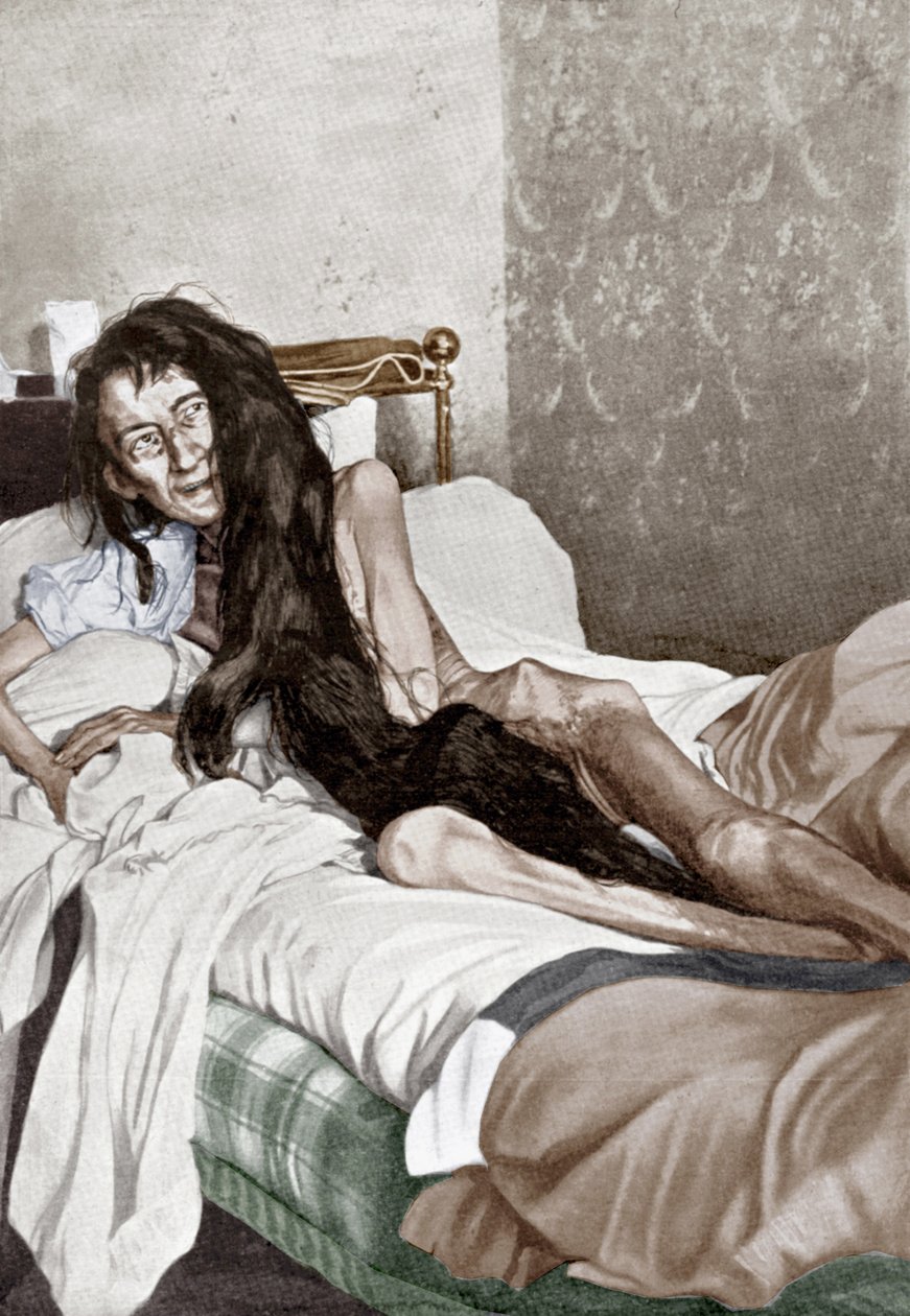 Blanche Monnier no hospital, Poitiers, junho de 1901 (gravura) de French School