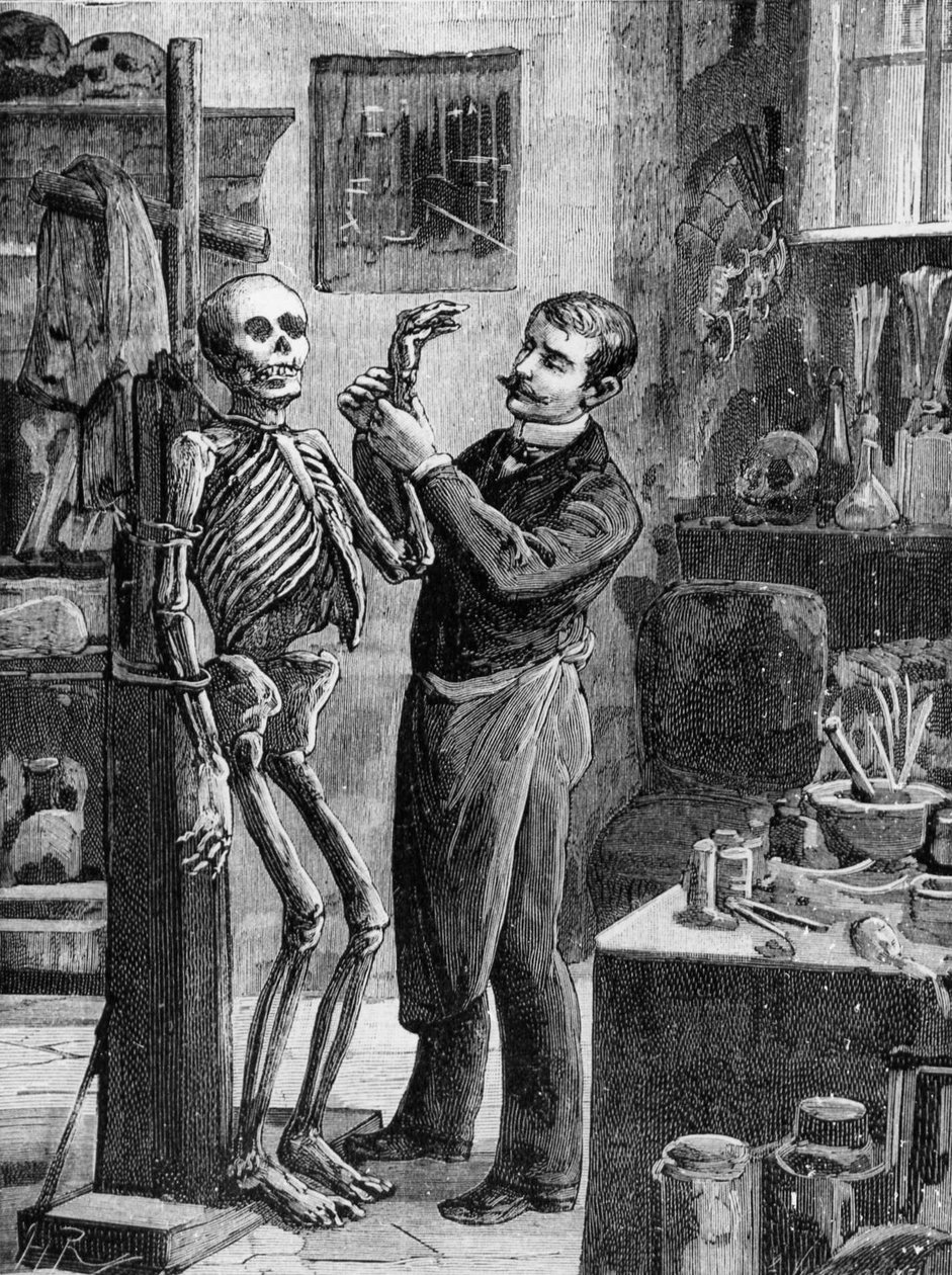Caso Gouffé: A reconstrução imaginária do corpo Gouffé pelo Dr. Lacassagne - em "La Malle Sanglante", ed. A. Fayard, Paris, n.d. - Paris, B.H.V.P.D. de French School