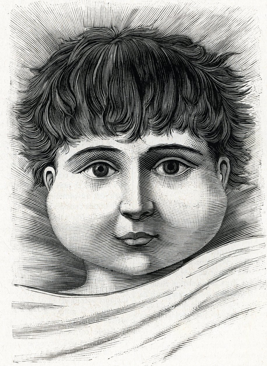 Criança com doença da papeira (gravura) 1888 de French School