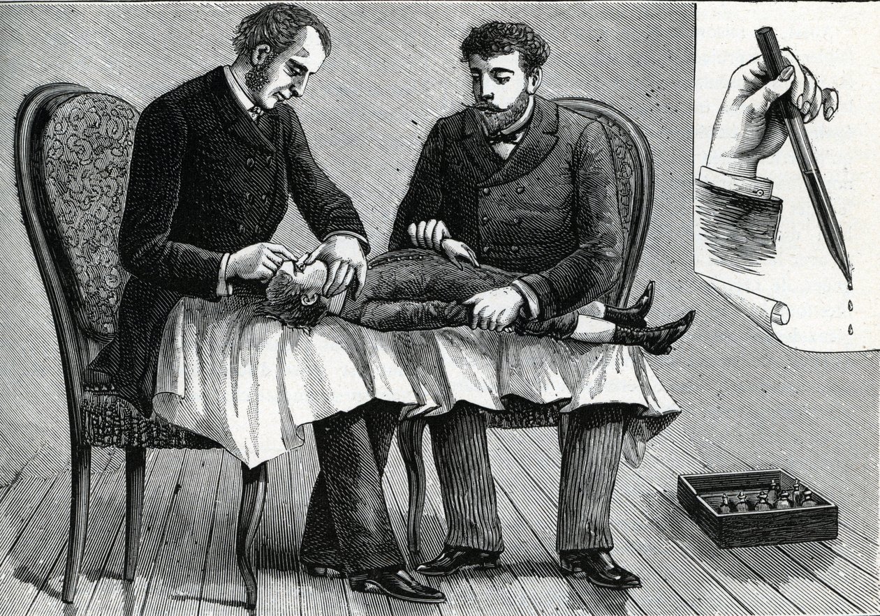 Médicos examinando os olhos de uma criança e injetando colírio (gravura) 1888 de French School