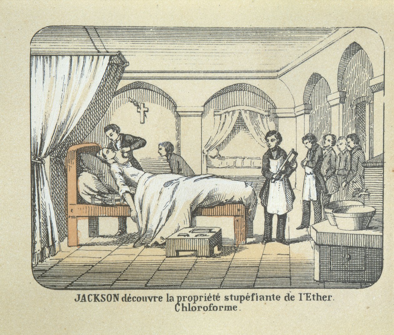 Dr. Charles Jackson (1805-80) descobre as qualidades anestésicas do éter de French School