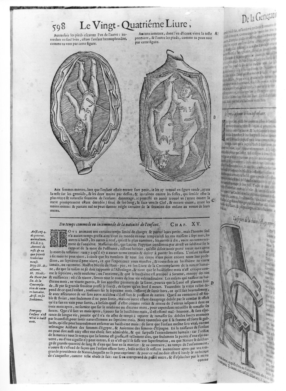 Feto, ilustração de Obras de Ambroise Pare (1509-90) publicado em Lyon, 1641 de French School