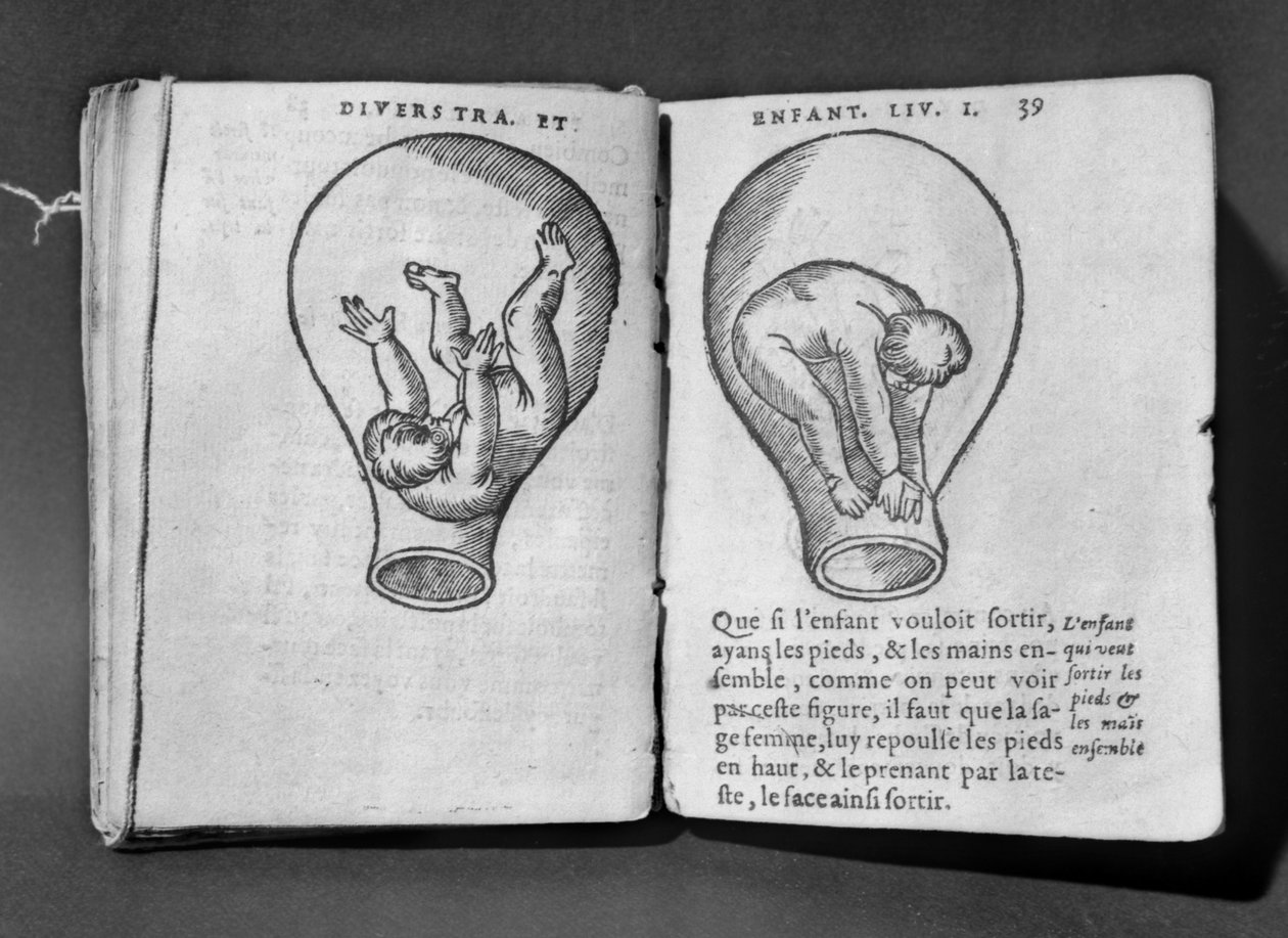 Feto no útero, ilustração do chamado manuscrito de Rodião de French School