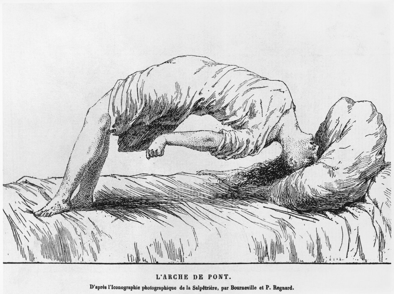 Histeria e sonambulismo, de Les Maladies Epidemiques de l&39;Esprit de Paul Regnard (1850-1927) 1884 de French School