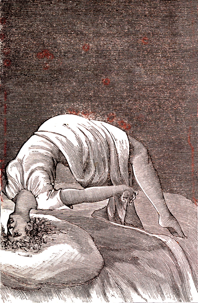 Histeria, perturbação mental e nervosa resultante de uma ansiedade intensa. 1887 (gravura) de French School