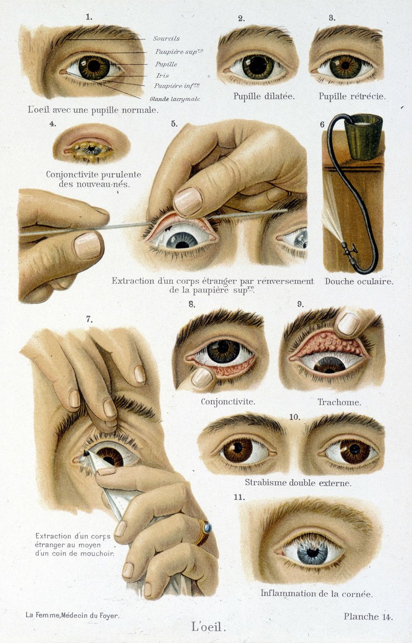 Medicina: o olho. de French School