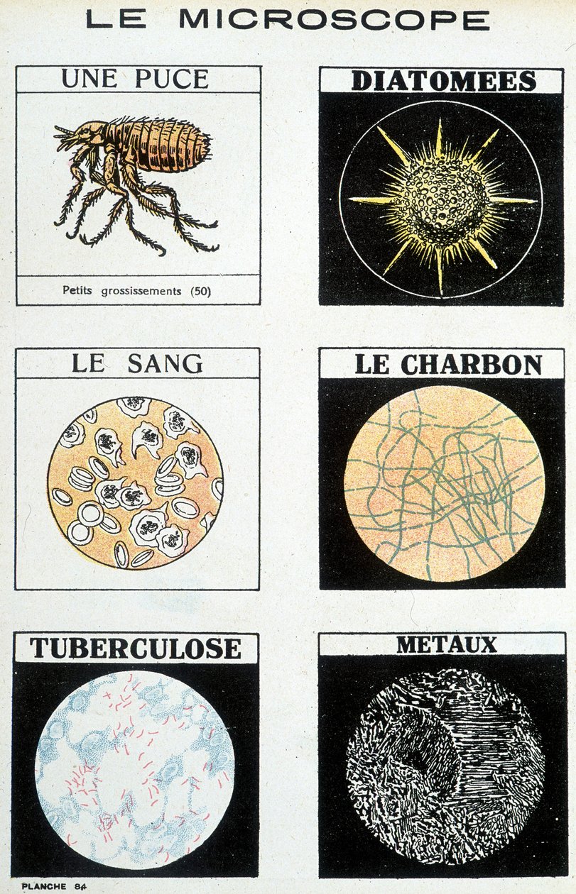 Microscópios: um chip, diatomáceas, sangue, carvão, tuberculose, metais. de French School