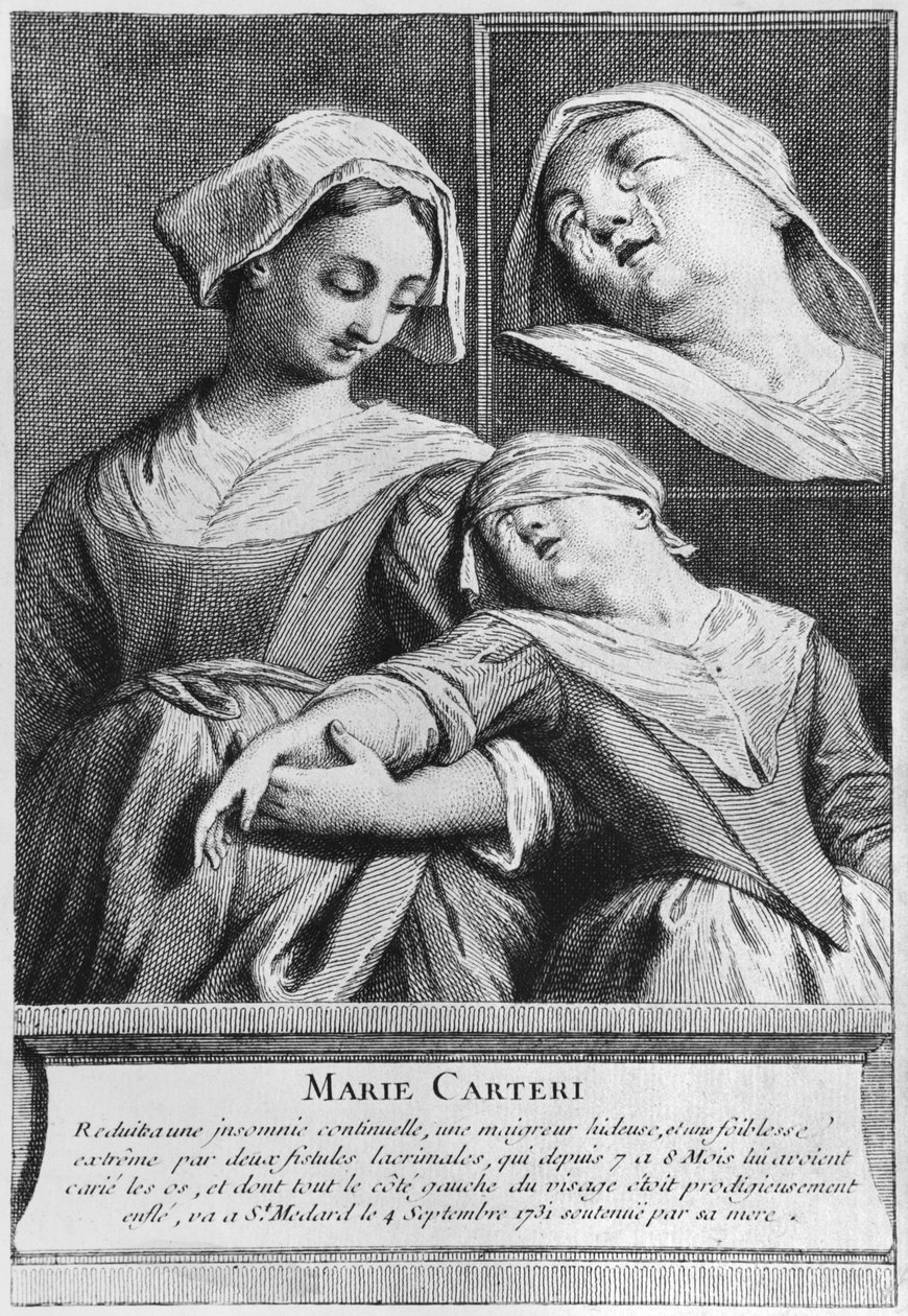 Cura milagrosa de uma mulher cega, Marie Carteri, no túmulo do diácono François de Paris, no cemitério paroquial de Saint-Medard, em Paris de French School