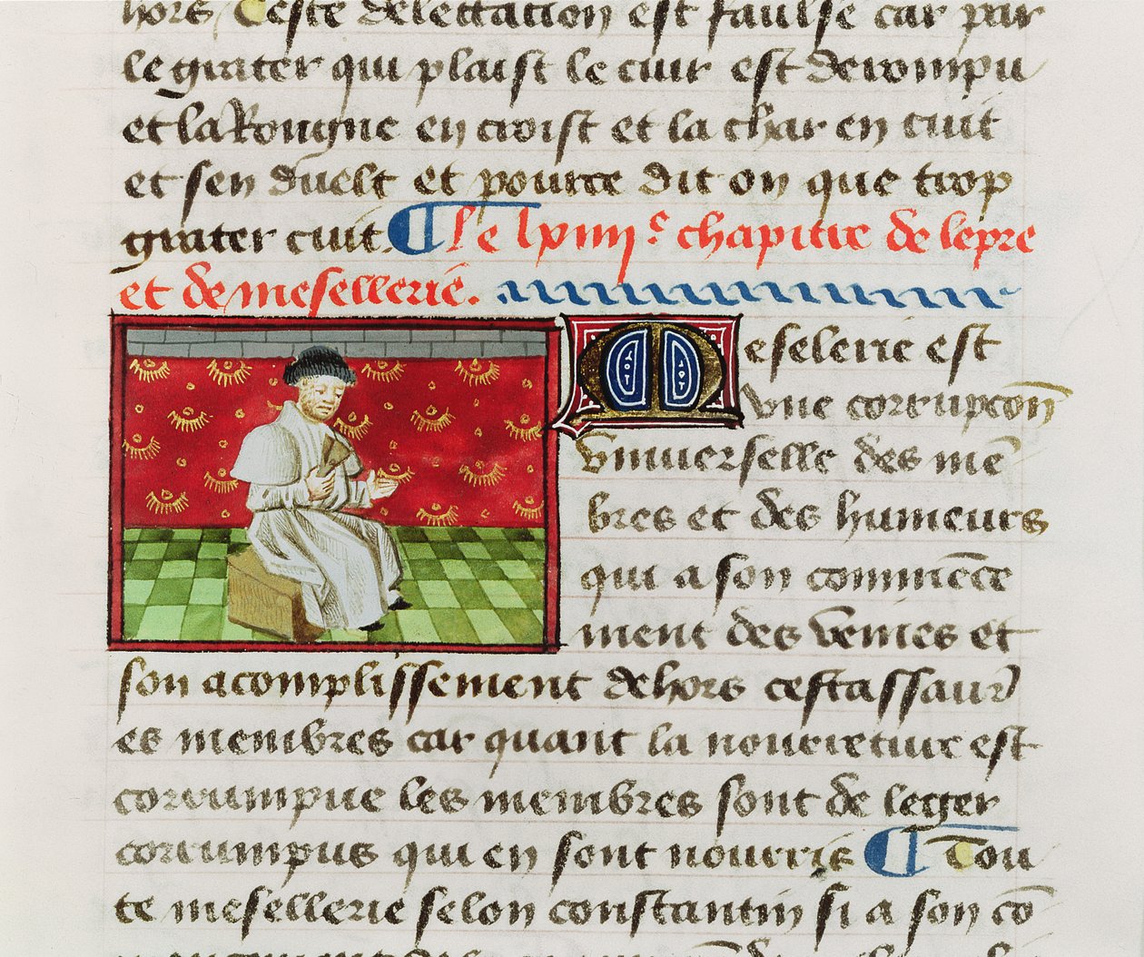 Ms.Fr.22532 Fol.118 Leper, de O Livro das Coisas por Barthelemy lEnglais de French School
