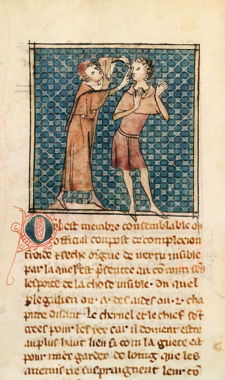 Ms 2030 fol.17 Oftalmologia, ilustração da Cirurgia do Mestre Henri de Mondeville de French School