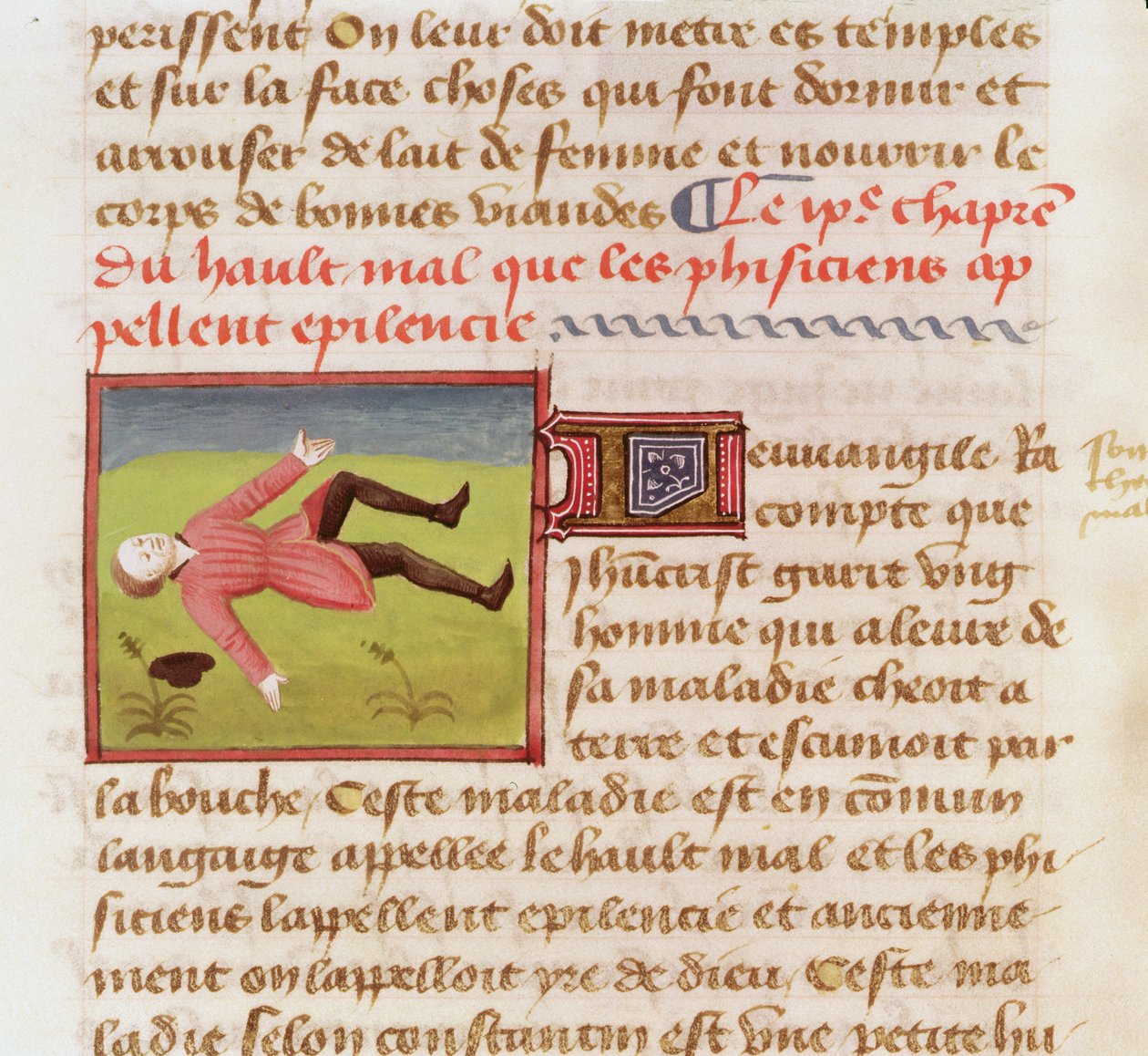 Ms 22532 Paciente que sofre de um ataque epiléptico, de O Livro das Coisas das Coisas de Barthelemy English, c. 1410-1415 de French School