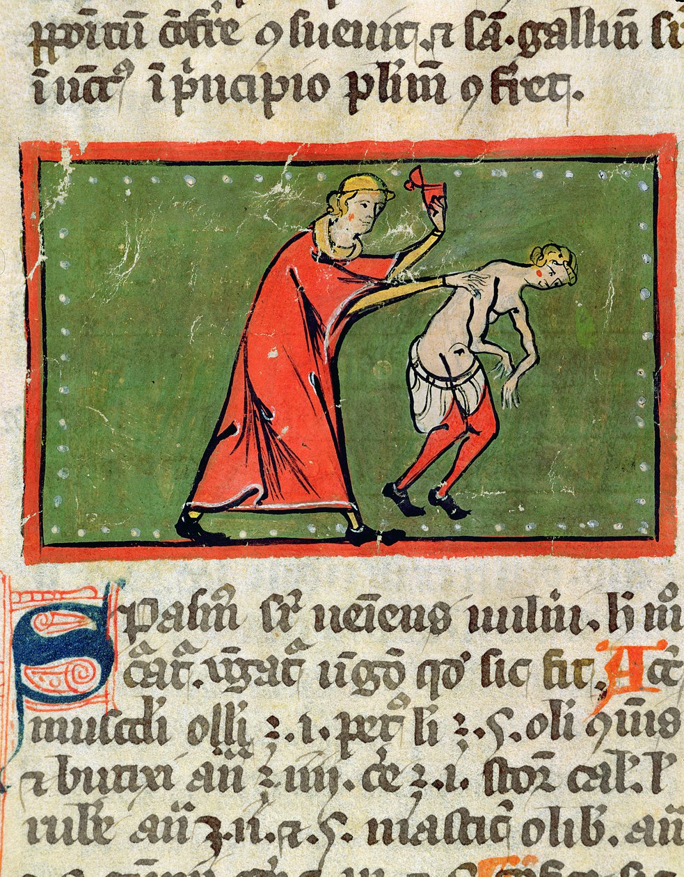 Ms H 89 Médico tratando os pacientes de volta, de uma edição do Livro de Cirurgia de Rogier de Salerne de French School