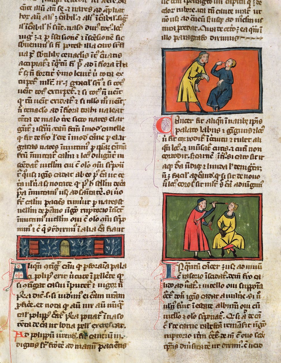 Ms H 89 Médicos e Pacientes, de uma edição do Livro de Cirurgia de Rogier de Salerne de French School