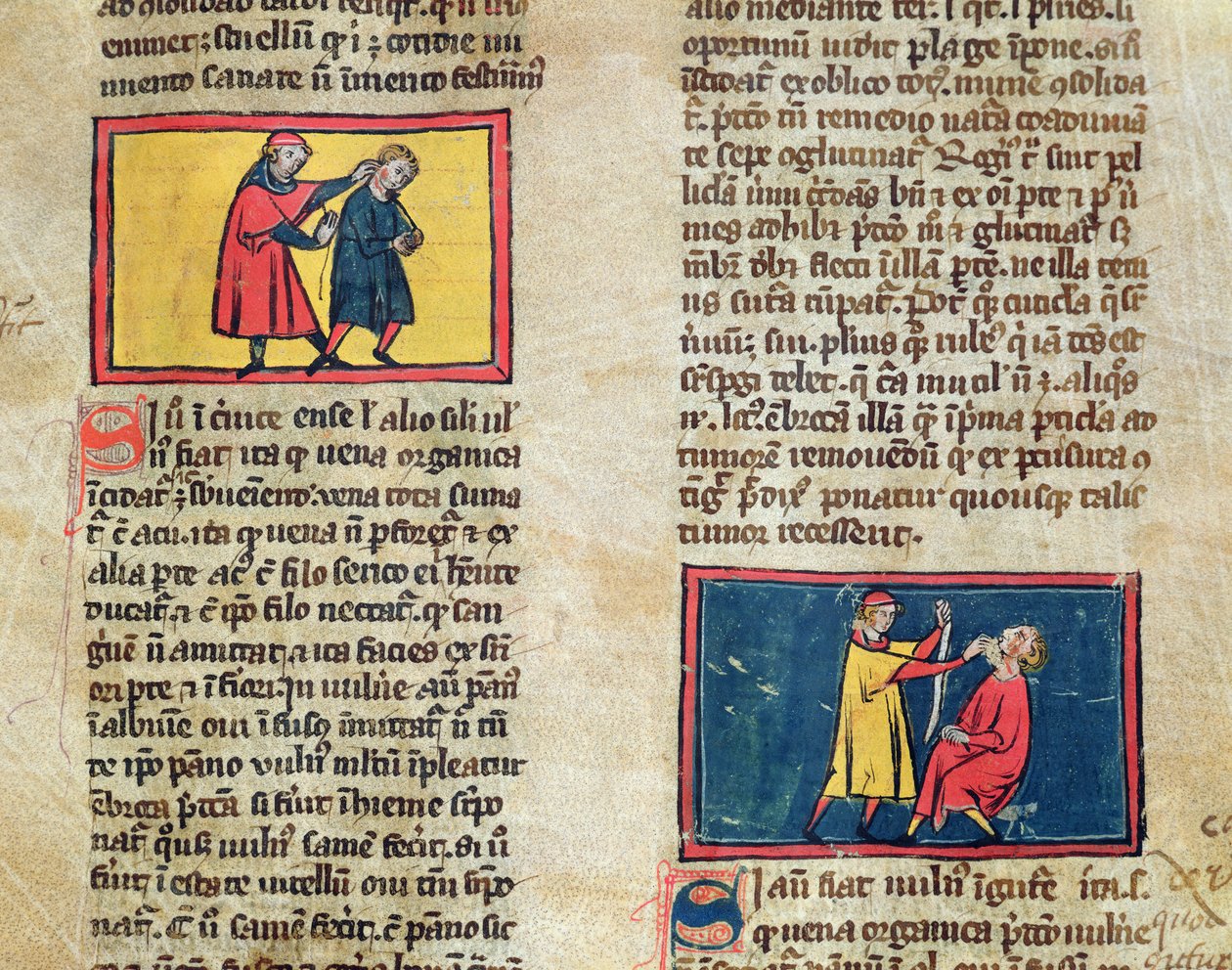Ms H 89 Médicos e pacientes, de uma edição do Livro de Cirurgia de Rogier de Salerne de French School
