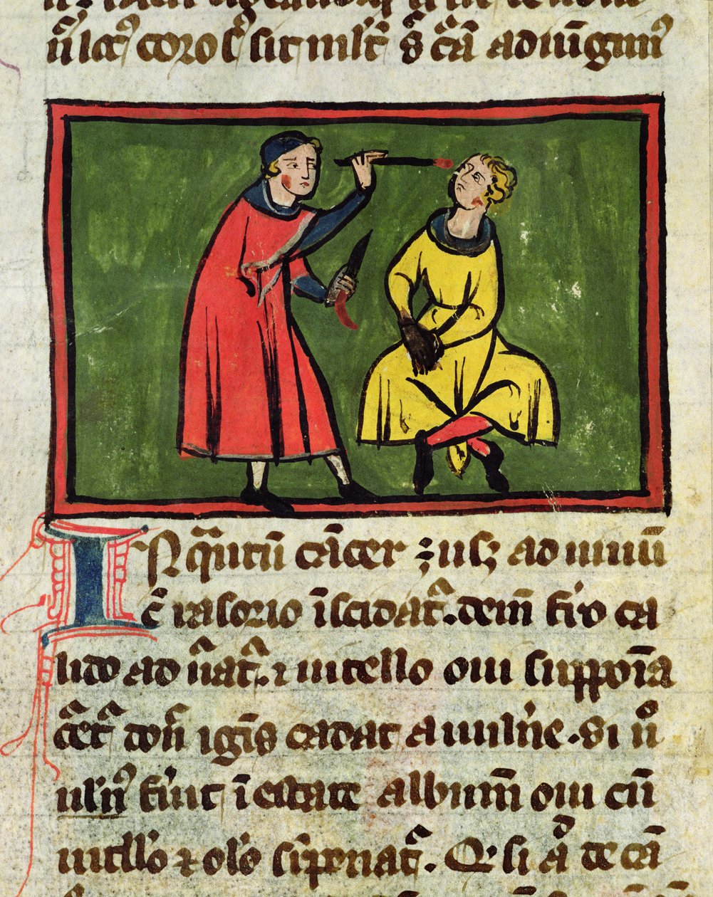 MS H 89 Tratamento cirúrgico, de uma edição do livro de cirurgia de Rogier de Salerne de French School