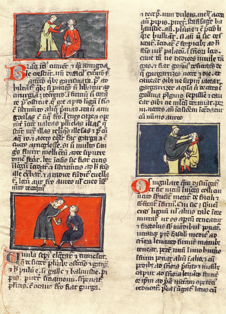 Ms H 89 fol.16v Cirurgia Dentária, de uma edição do &39;Book of Surgery&39; por Rogier de Salerne de French School
