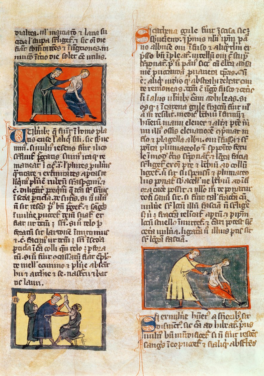 Ms H 89 fol.17r Cirurgia, de uma edição do &39;Livro de Cirurgia&39; por Rogier de Salerne de French School
