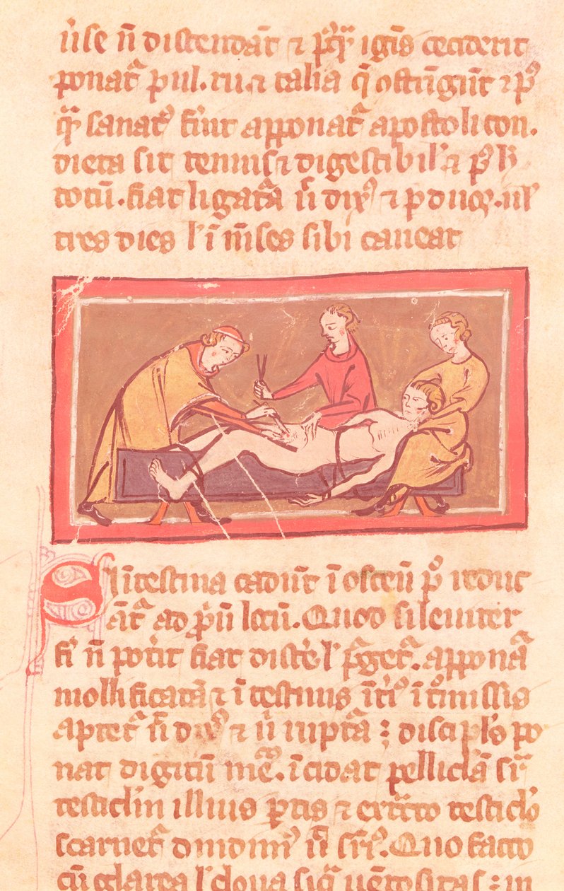 Ms H 89 fol.23 Cirurgia, de uma edição do livro de cirurgia por Rogier de Salerne de French School