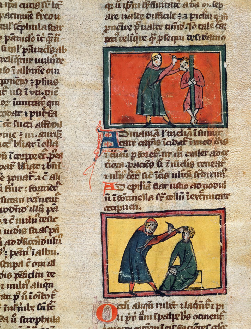 Ms H 89 fol.3 Médicos tratando os doentes, de uma edição do Livro de Cirurgia de Rogier de Salerne de French School