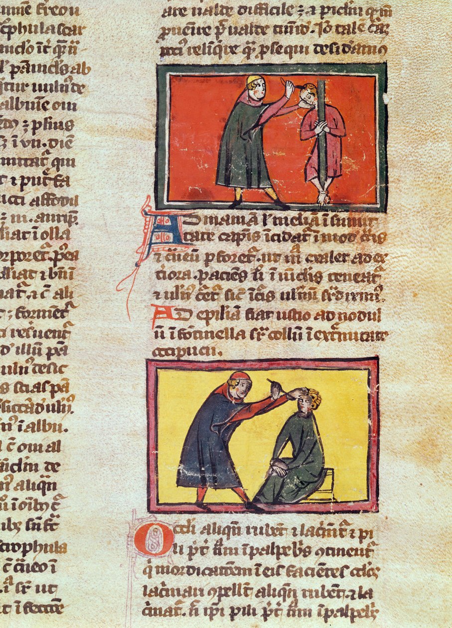 Ms H 89 fol.6 Surgery, de uma edição do &39;Book of Surgery&39; por Rogier de Salerne de French School