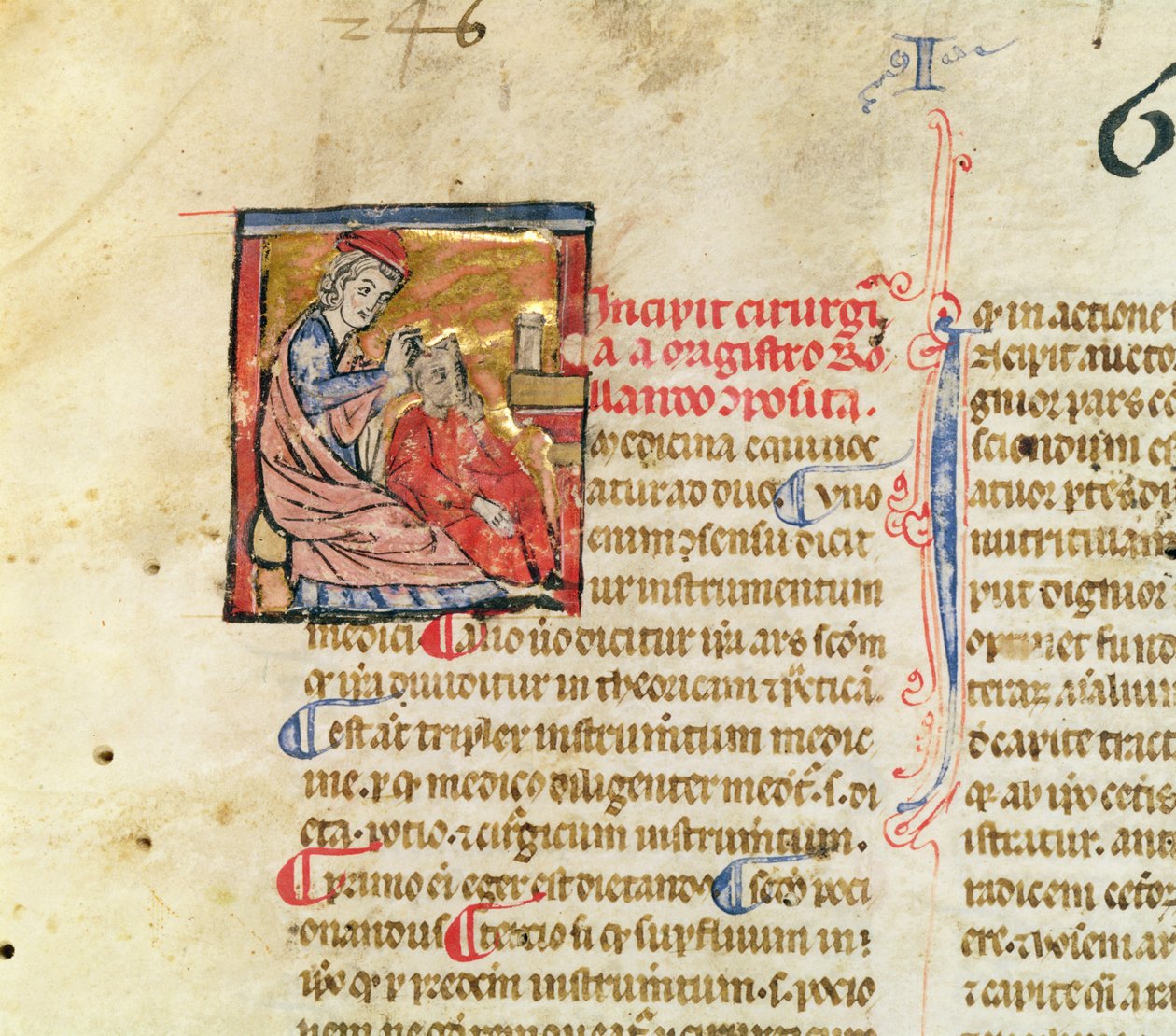 Senhora Lat. 7134 fol.1 Trepanation, da Chirugie da Master Rolandi de French School