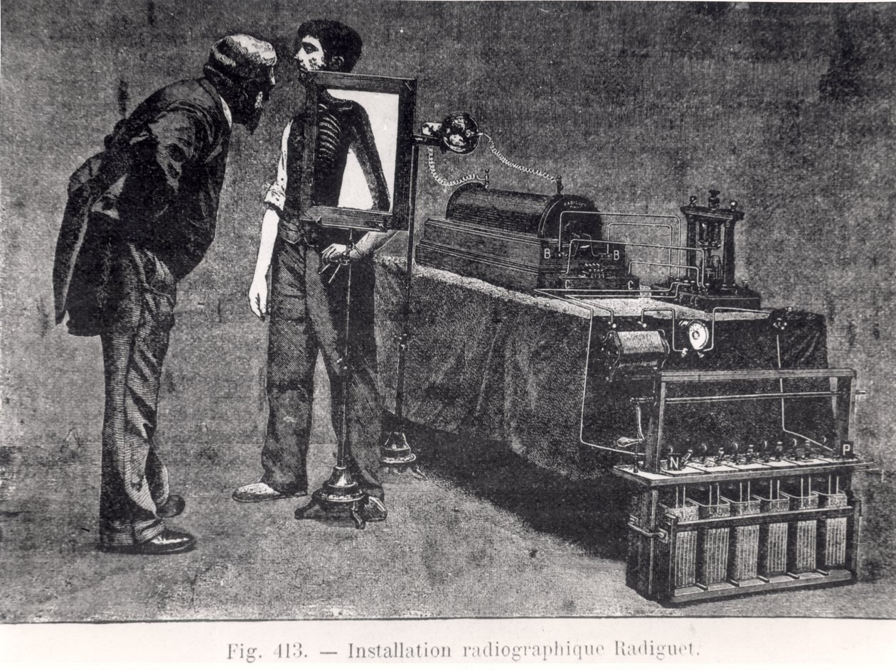 Máquina de radiologia Radiguet de French School