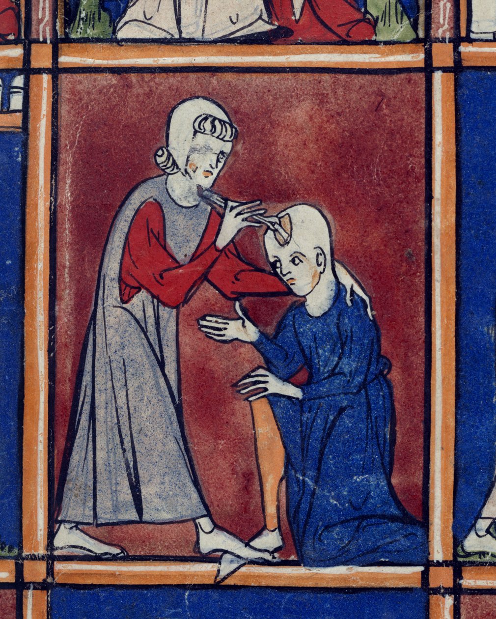Sloane 1977 f.2 Operação no crânio de um paciente, ilustração de 