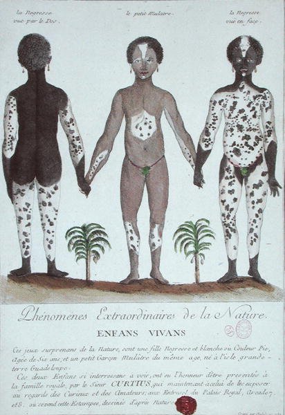 O Fenômeno de Leukoderma de French School