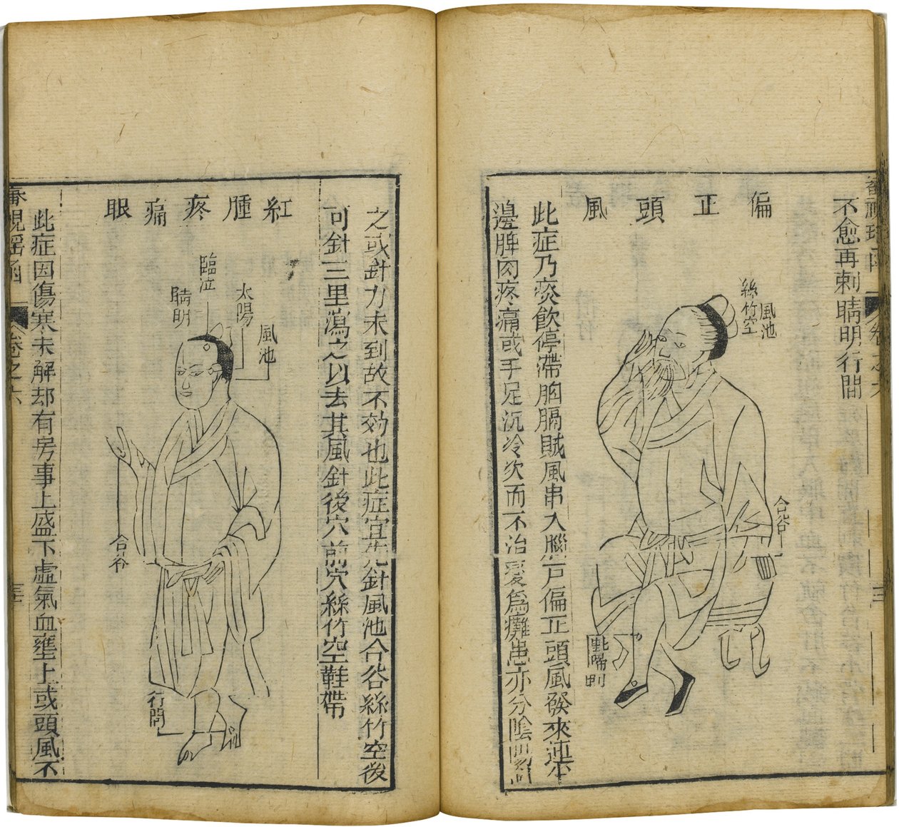 Shen Shi Yao Han Um precioso livro de oftalmologia, 1644 de Fu Renyu