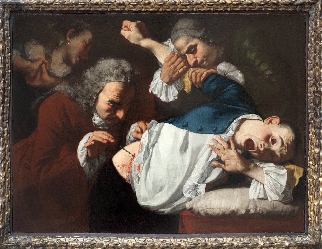 Operação. Pintura por Gaspare Traversi (ca. 1722-1770), óleo sobre tela, ca. 1753-1754. Arte italiana do século XVIII. Staatsgalerie Stuttgart (Alemanha). de Gaspare Traversi