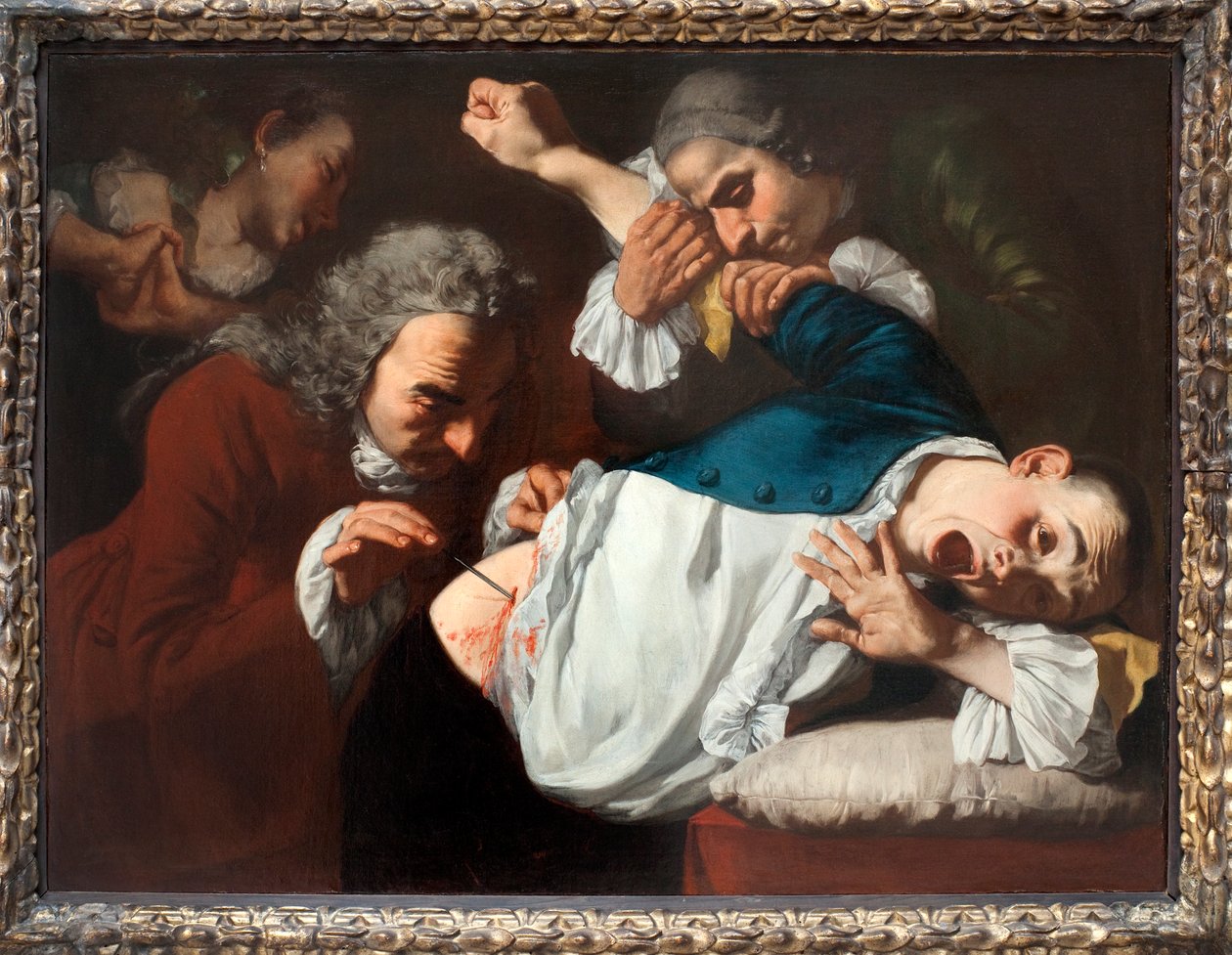 A operação, 1753-54 de Gaspare Traversi