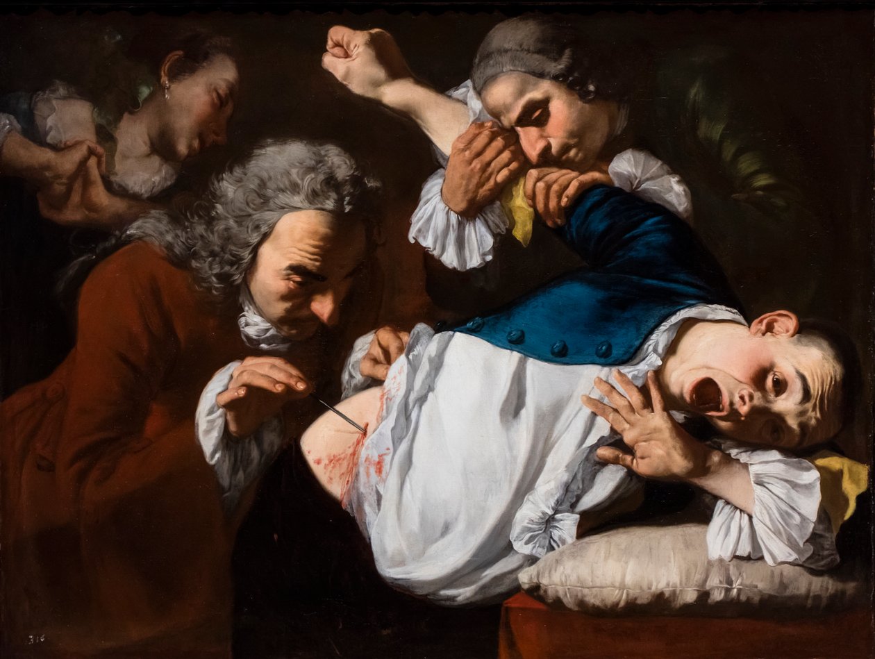 A Operação, cerca de 1753/54 (óleo sobre tela) de Gaspare Traversi