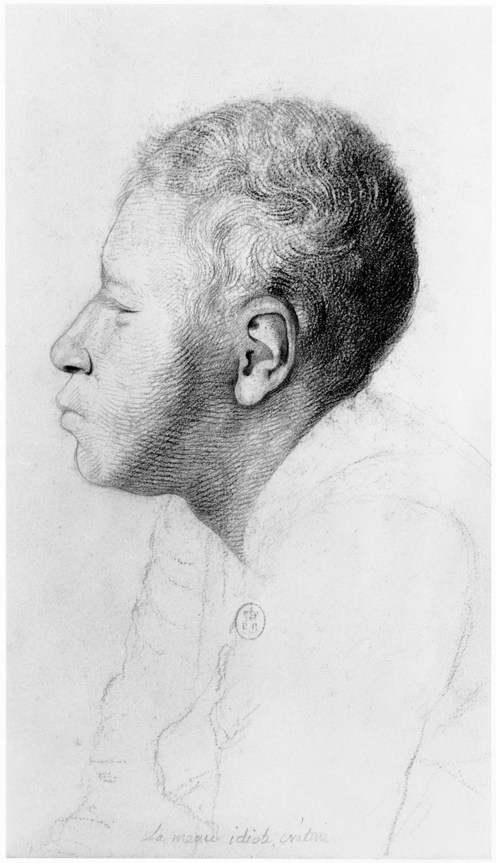 Cretin, perfil, ilustração de um tratado inédito de Jean Etienne Dominique Esquirol (1772-1840) sobre os lunáticos do asilo Salpetriere, c.1818 de Georges Francois Gabriel