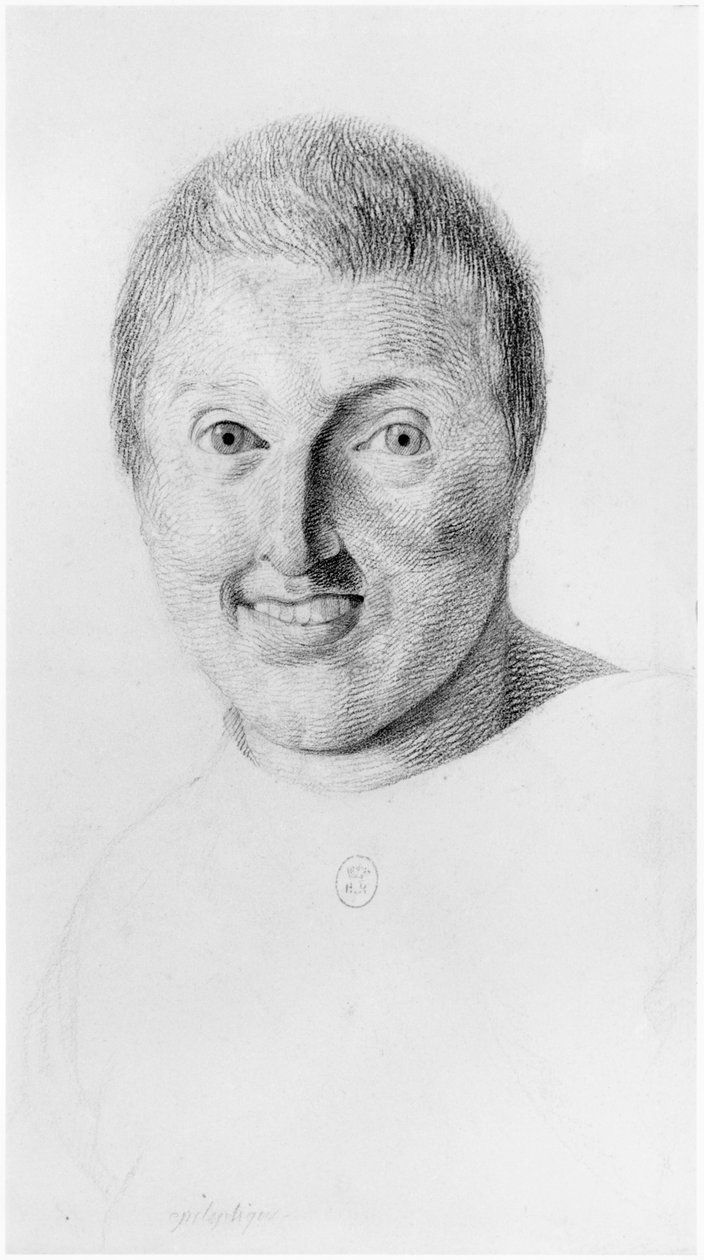Mulher epiléptica, vista frontal, ilustração de um tratado inédito de Jean Etienne Dominique Esquirol (1772-1840) sobre os lunáticos do asilo de Salpetriere, c.1818 de Georges Francois Gabriel
