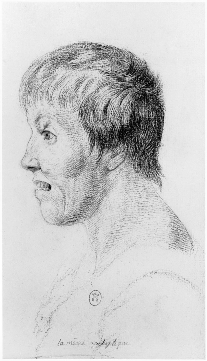 Mulher epiléptica, perfil, ilustração de um tratado inédito de Jean Etienne Dominique Esquirol (1772-1840) sobre os lunáticos do asilo Salpetriere, c.1818 de Georges Francois Gabriel