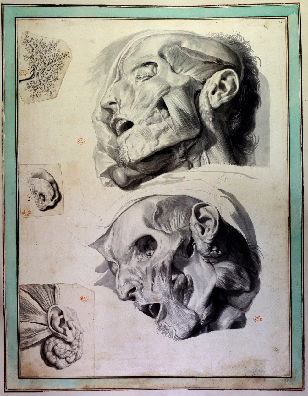 Cabeças humanas descascadas: músculos e esqueletos são visíveis. Gravura de Gerard de Lairesse (1640-1711) ilustrando a "Anatomia Humani Corporis" do Governo Bidloo (ou Govard) (1649-1713) Biblioteca do século XVIII da Faculdade de Medicina, Paris de Gerard de Lairesse