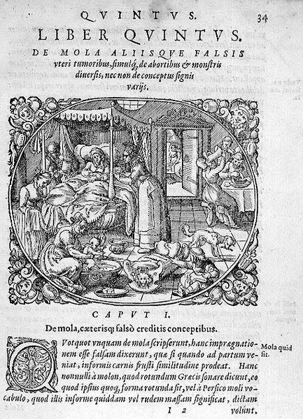 Após o nascimento, ilustração do capítulo 1, Livro 5 de "Sobre a Concepção e Crescimento do Homem" de Rueff de German School