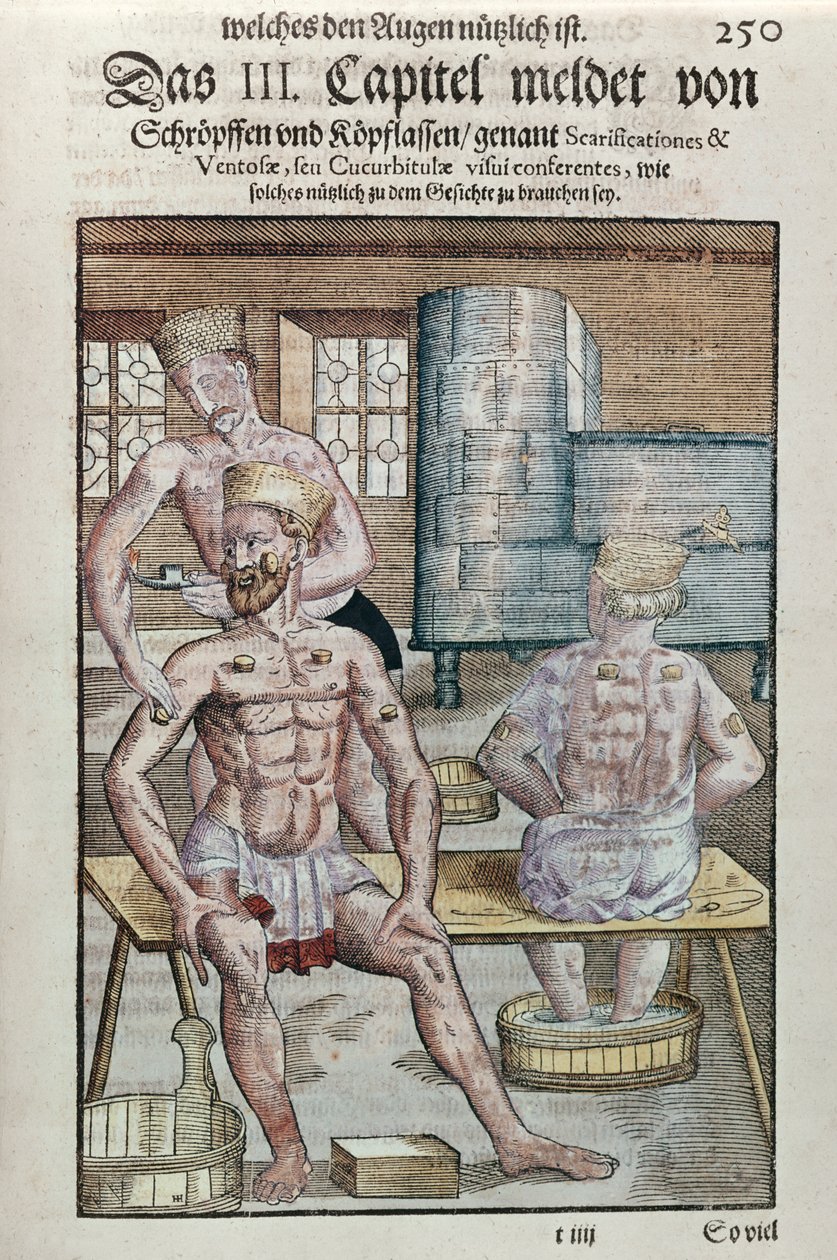 Cupping, de Ophthalmodouleia por Georg Bartisch (1535-1636) publicado em Dresden em 1583 (impressão em xilogravura a cores) de German School