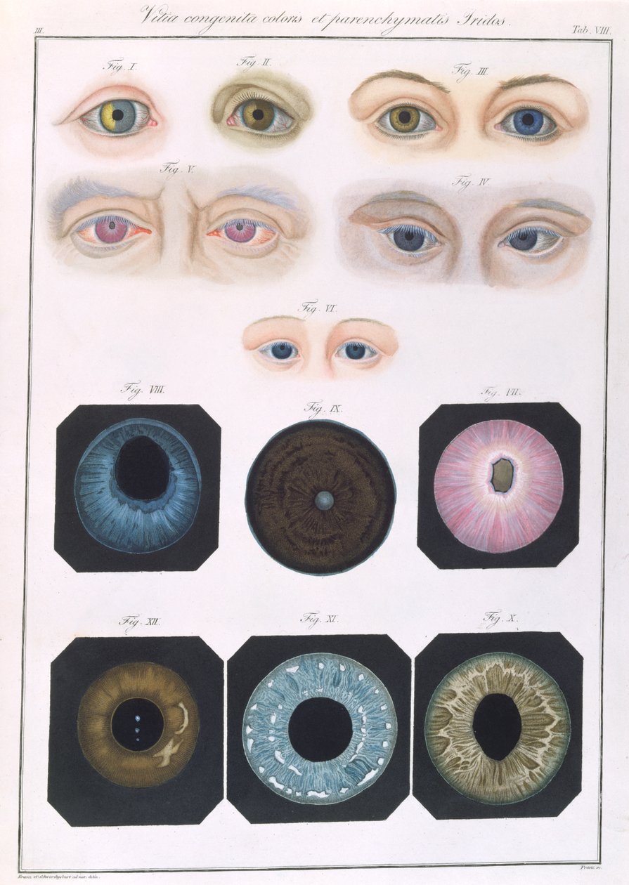 Descrição das anomalias congênitas dos olhos, de Representações Clínicas de Doenças e Erros Cegantes do Olho Mesnschlichen, de Friedrich August von Ammon (1799-1861) 1838 de German School