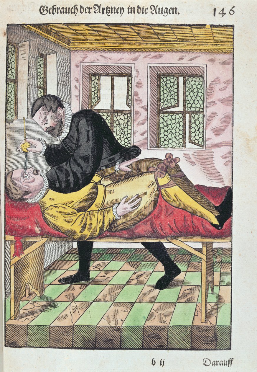Eye Operation, de Ophthalmodouleia por Georg Bartisch (1535-1636), publicado em Dresden em 1583 (impressão em xilogravura a cores) de German School
