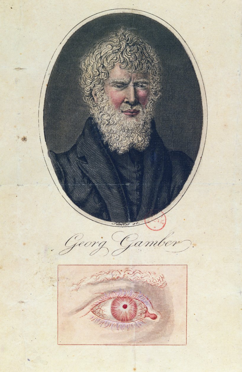 Georg Gamber, um albino de German School