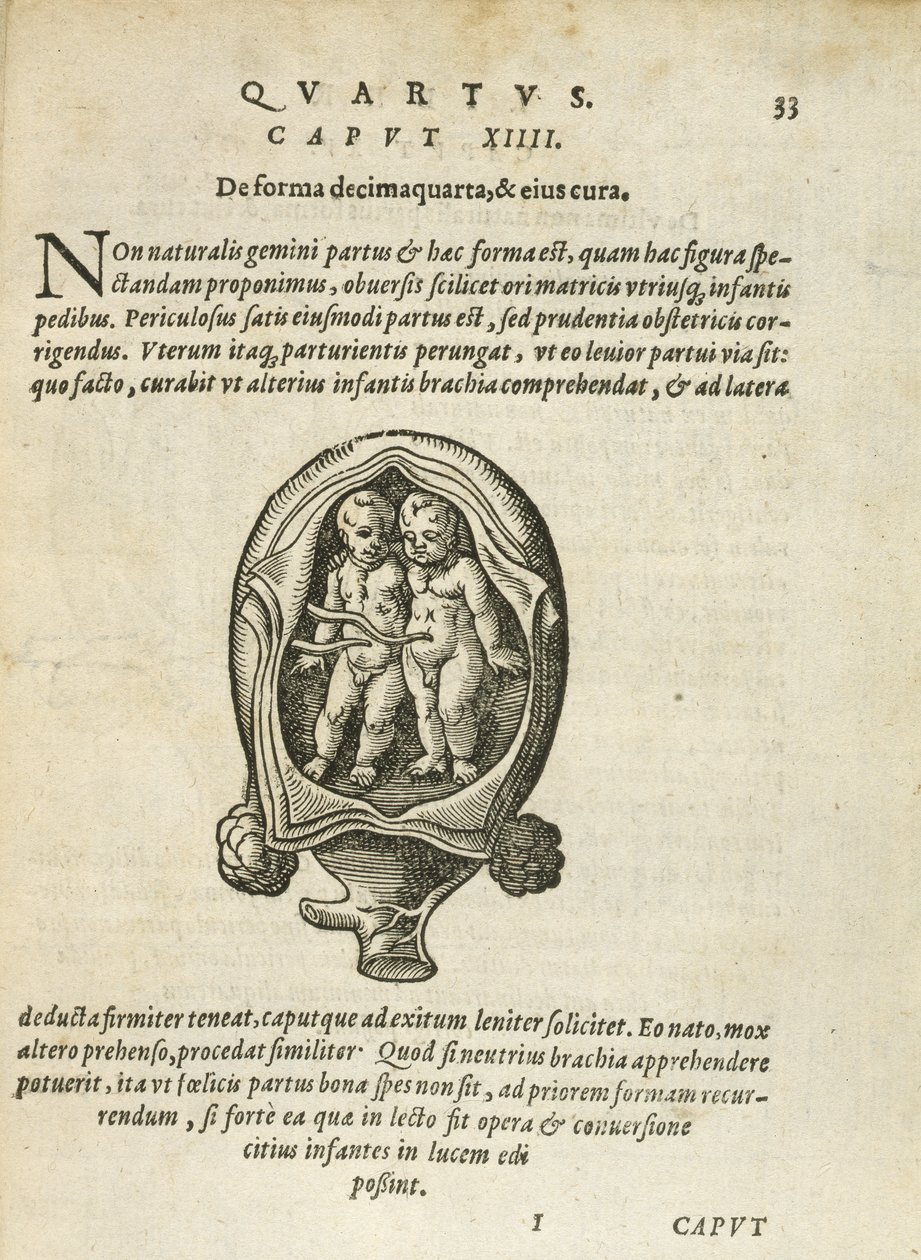 Gêmeos não-idênticos no útero, ilustração do capítulo 14, livro 4 de Na concepção e crescimento do homem, de Rueff, 1587 de German School