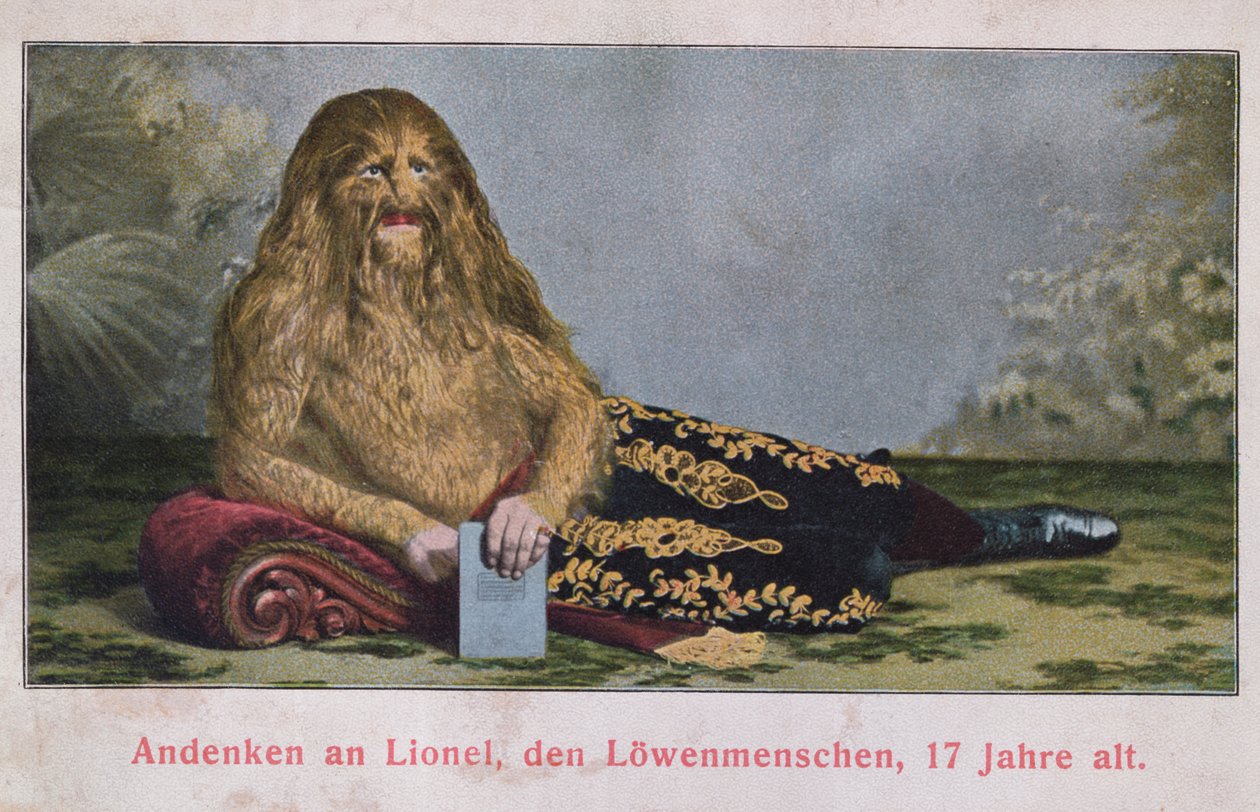 Postal retratando Lionel, o Menino Leão, de 17 anos, 1909 de German School