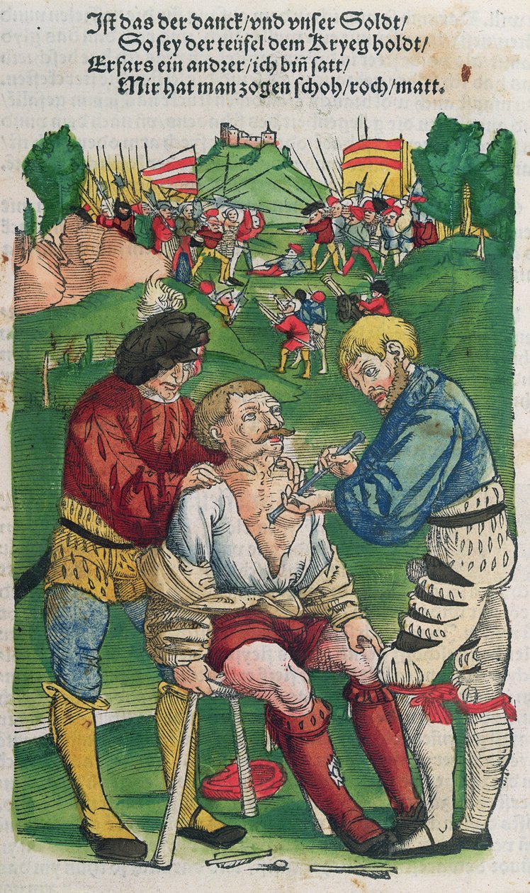 Removendo uma flecha, ilustração de Feldtbuch der Wundartzney por Hans von Gersdorff, 1540 de German School