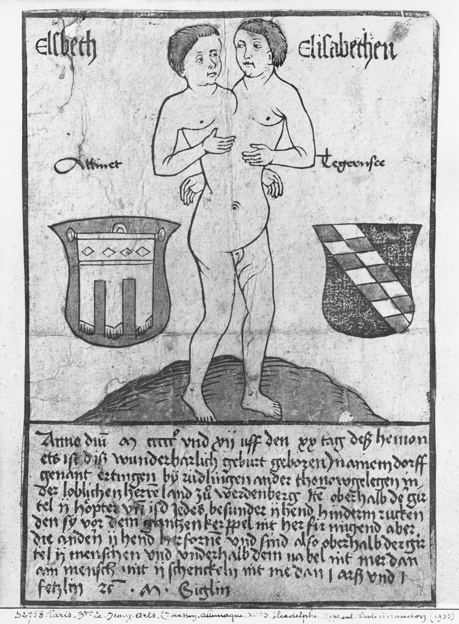 Meninas siamesas, Elsbeth e Elisabethen (woodcut e wc) de German School