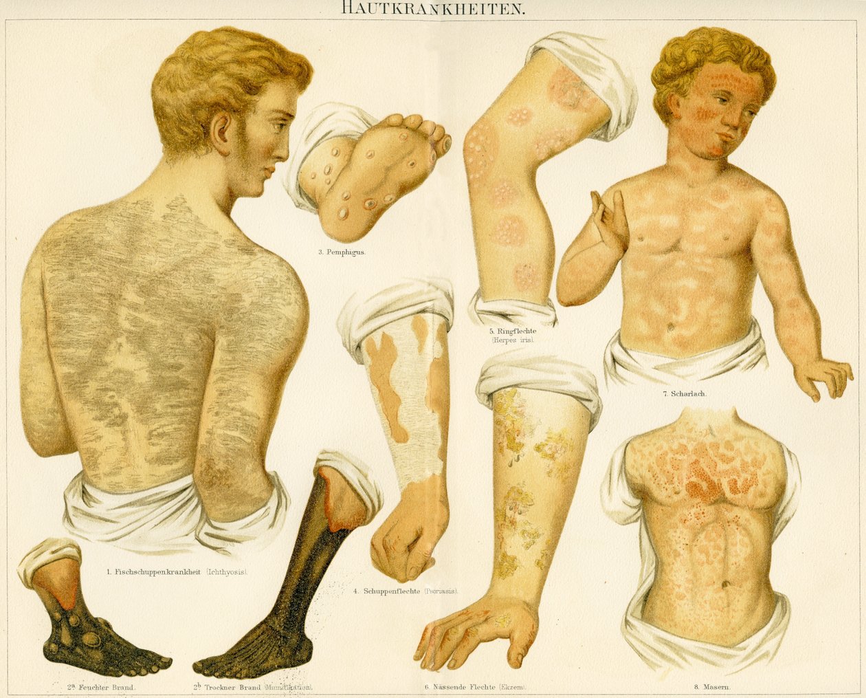 Afecções da pele, c.1890 de German School