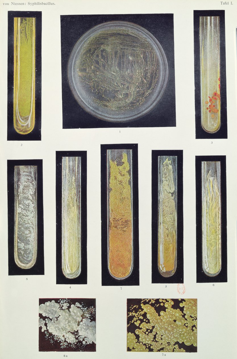 Syphilus Bacillus, de um livro de Max von Niessen, Leipzig, 1908 de German School